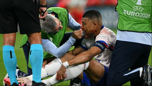 Kylian Mbappé sufrió una lesión en la nariz en el Francia vs. Austria de la Eurocopa. Foto: AFP