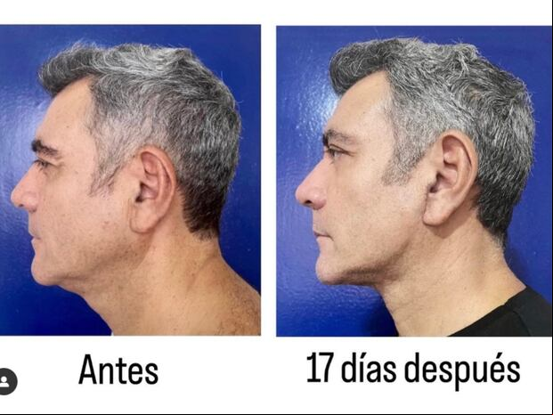 El antes y después del rostro de la celebridad (Foto: Héctor Sandarti / Instagram)